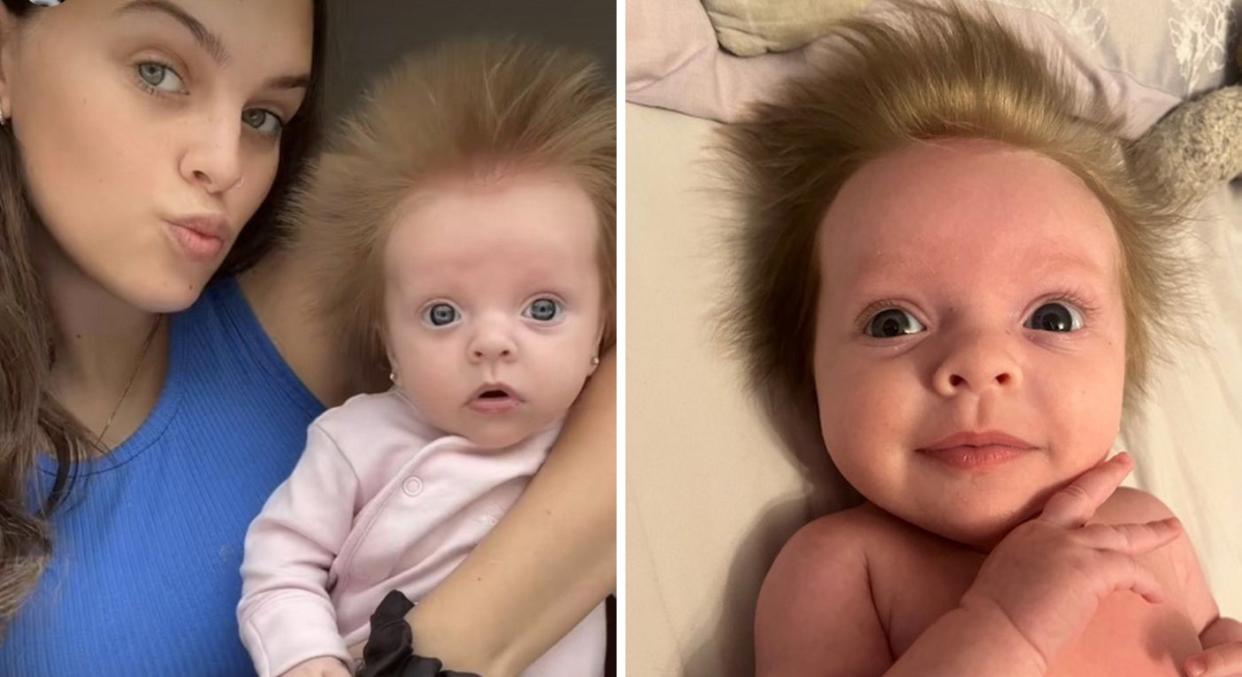 A mother has been documenting her baby's 'crazy' hair after her hair started growing upwards in all directions. (Aliyah Lewis/SWNS)