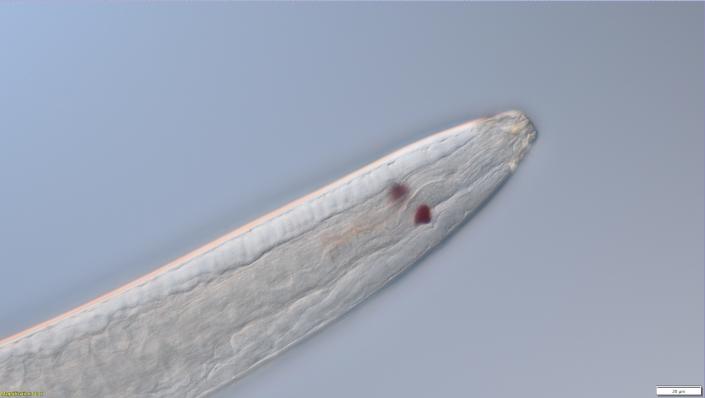 Imagen microscópica de un nematodo toracostoma.