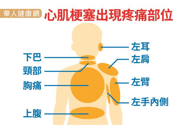 天熱傷「心」3禍首！防心肌梗塞必知護心4訣竅