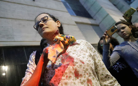 A demonstrator reacts as she shows an injury from a rubber bullet during clashes with riot police in a protest against President Michel Temer's proposal reform of Brazil's social security system during general strike in Rio de Janeiro, Brazil, April 28, 2017. REUTERS/Ricardo Moraes