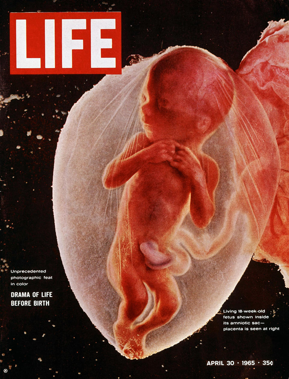 The cover of LIFE Magazine features a photograph of an 18-week-old fetus inside its amniotic sac, April 30, 1965.