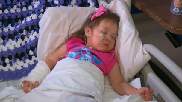 PHOTO: Two-year-old Jazlynmae Gonzalez just spent her birthday battling RSV in the pediatric ICU at the University of New Mexico Hospital in Albequrque. (ABC News)