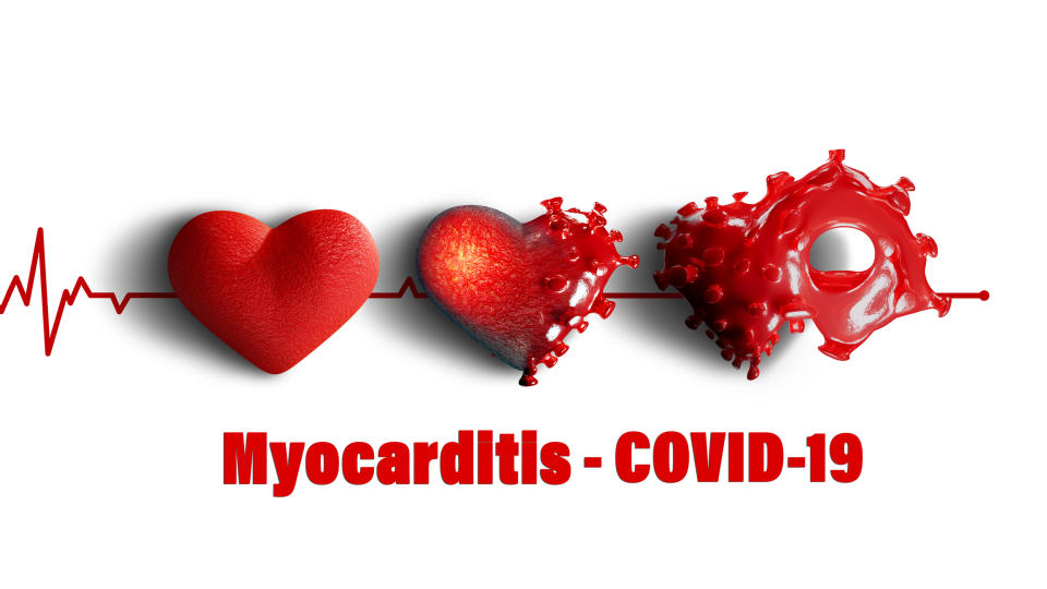 COVID-19 attacks the heart muscle causing its inflammation. This can lead to a heart attack. Source: Getty