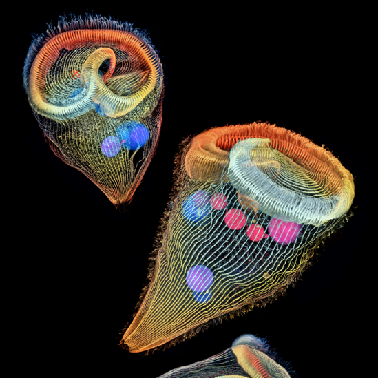 Igor Siwanowicz, del Centro Médico Howard Hughes en Estados Unidos, ganó el segundo puesto con esta imagen de animálculos trompeta, organismos unicelulares filtradores, comunes en lagos y arroyos de agua dulce. Siwanowicz logró captar los detalles de los cilios, los apéndices similares a pelos con los que se desplazan y alimentan.