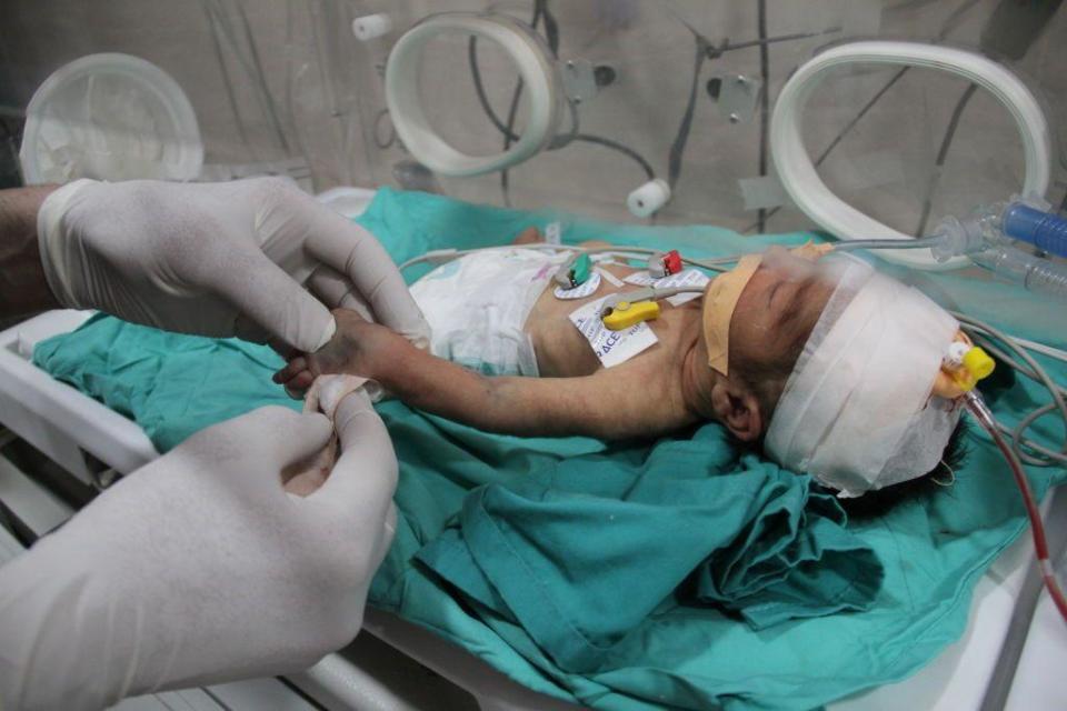 El hospital Kamal Adwan intenta tratar a bebés y niños gravemente malnutridos con recursos básico limitados, como la leche. (BBC)