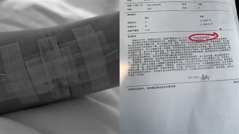 邵晴曬出自己的憂鬱症診斷書與自殘照，澄清自己不是小三。（圖／翻攝自微博）