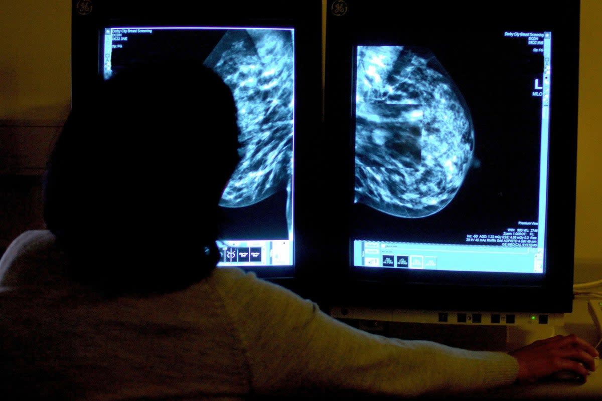 A consultant studies a mammogram (file picture)  (PA)