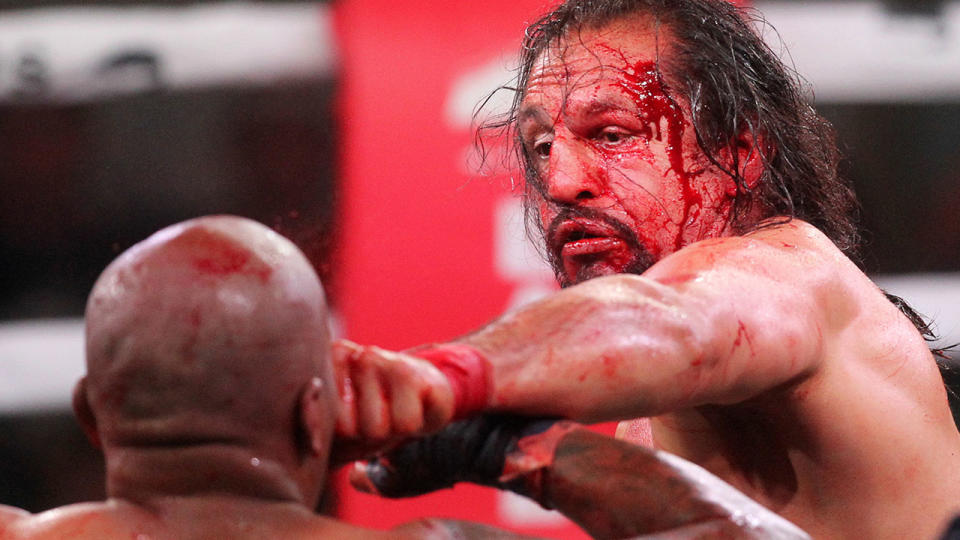 Lopez won the fight. Pic: AP