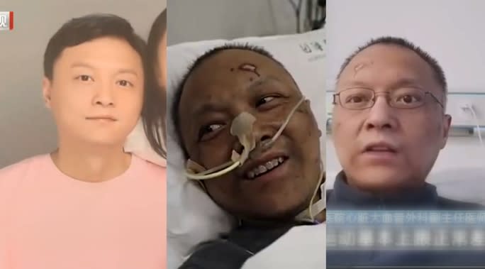 隨著住院99日，胡衛鋒醫師的病情逐漸好轉，膚色也漸漸恢復健康。（圖／翻攝自北京衛視）
