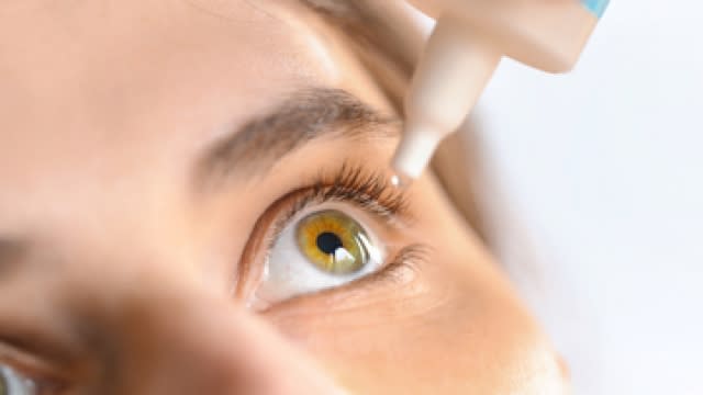 Stock photo of a woman applying an eye drop.