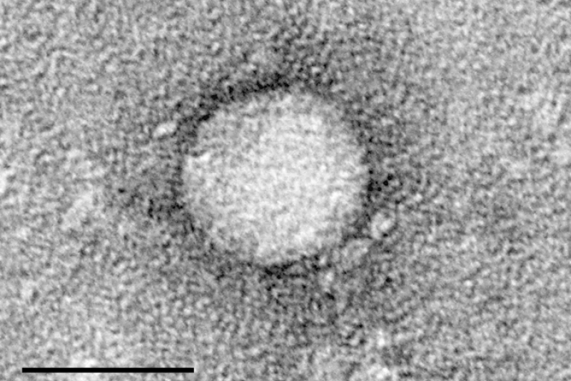 C型肝炎病毒（維基百科）