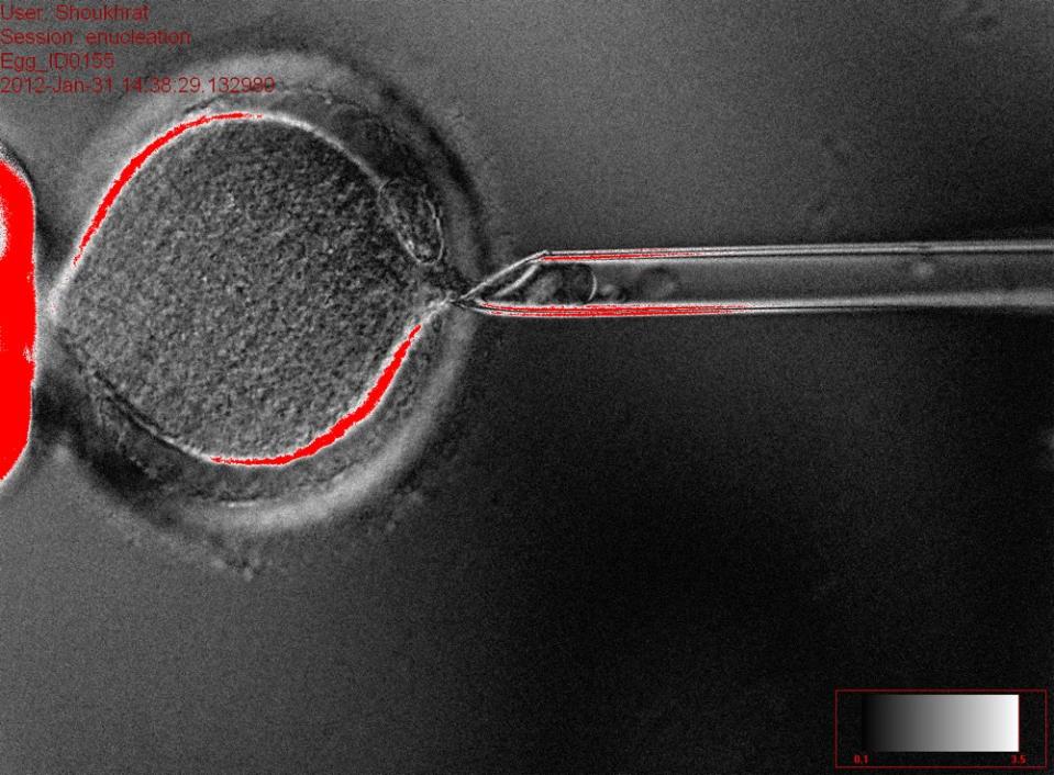 DNA removal from cell 