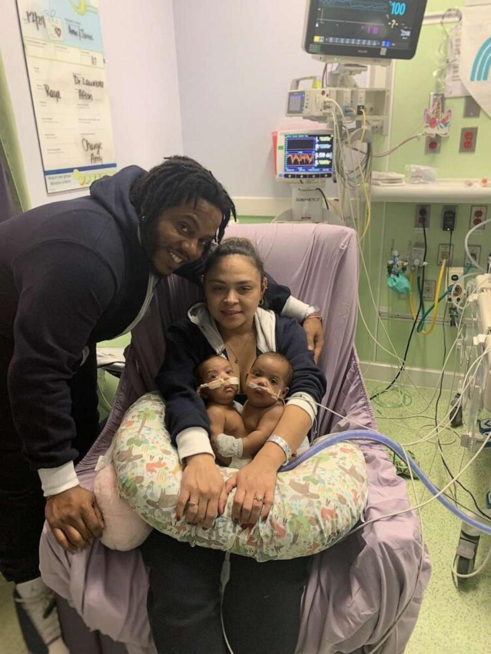 PHOTO: Amanda Arciniega and James Finley hold their conjoined twin daughters AmieLynn and JamieLynn prior to separation surgery. (James Finley)