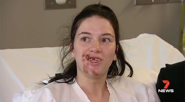 Taylor Hall will need plastic surgery after suffering serious facial injuries trying to save her dog during a terrifying carjacking. Source: 7 News