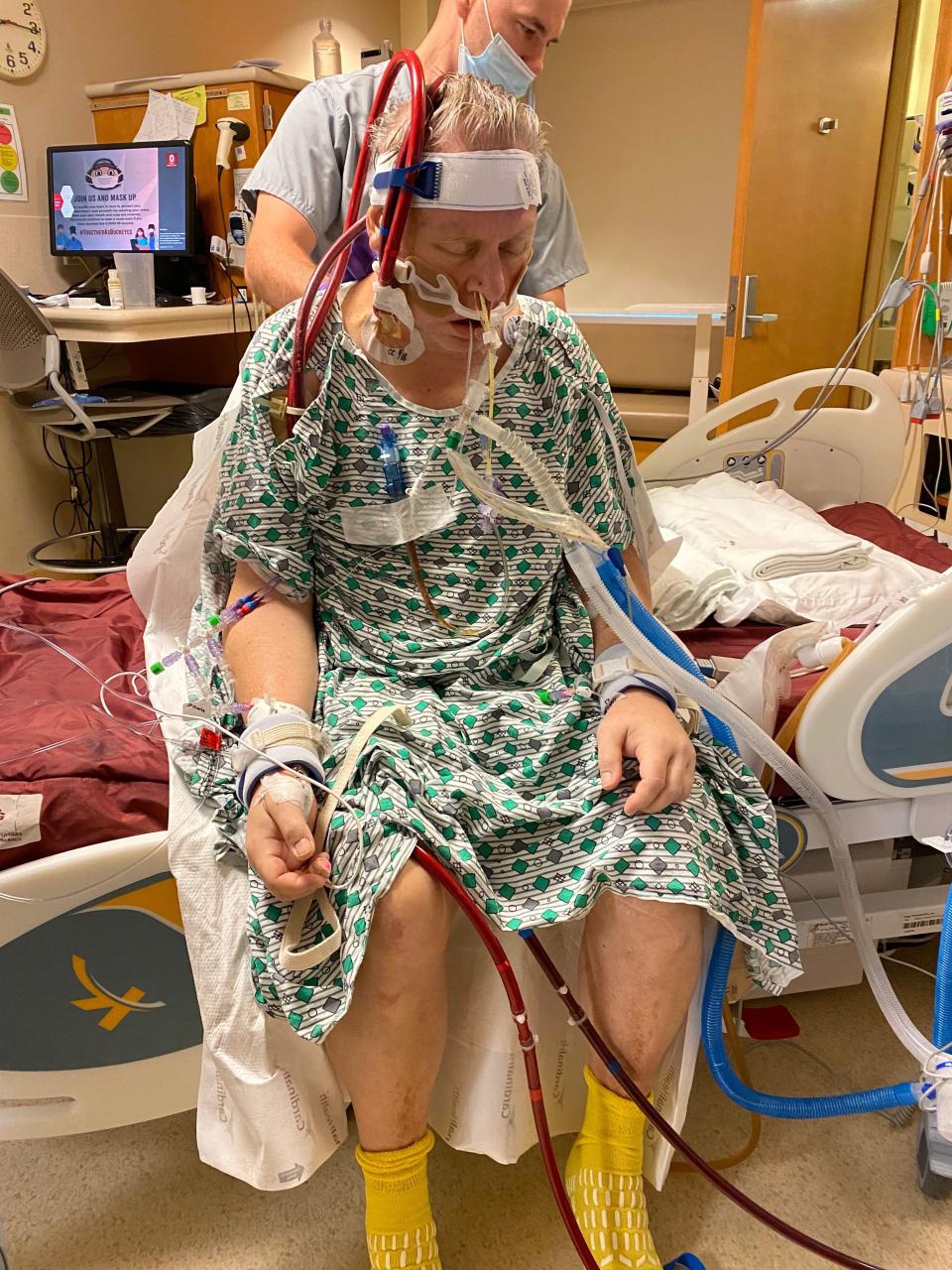 Mike Kaster, of Carmel, Indiana, after receiving a double lung transplant and concurrent bypass in September at the Ohio State University Wexner Medical Center in Columbus.