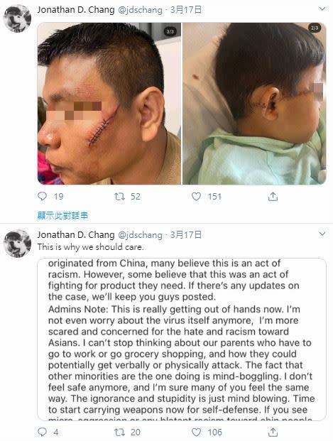 泰國裔一家人在美國德州超市遭人持利器攻擊，造成臉部皮開肉綻，幾乎毀容。（圖／翻攝自推特）