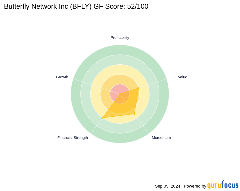 Larry Robbins' Strategic Acquisition in Butterfly Network Inc