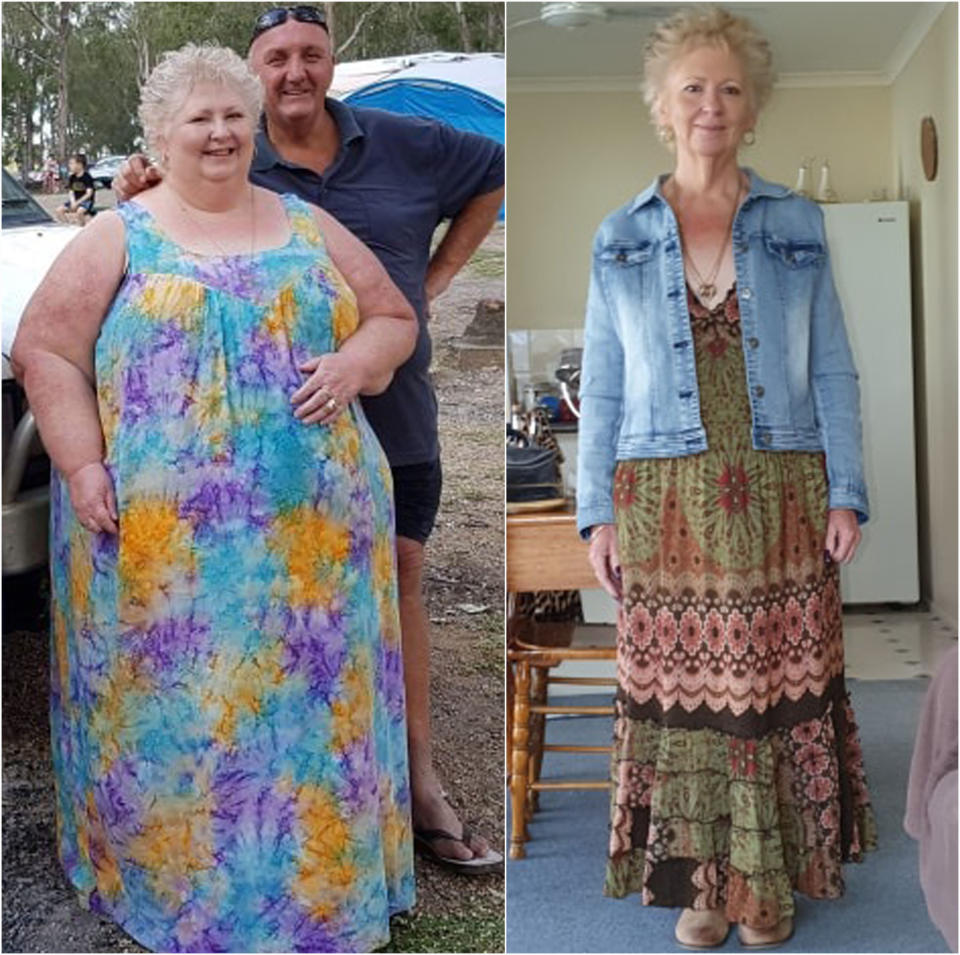 Queensland woman Carolyn Zurvas pictured before and after weight loss