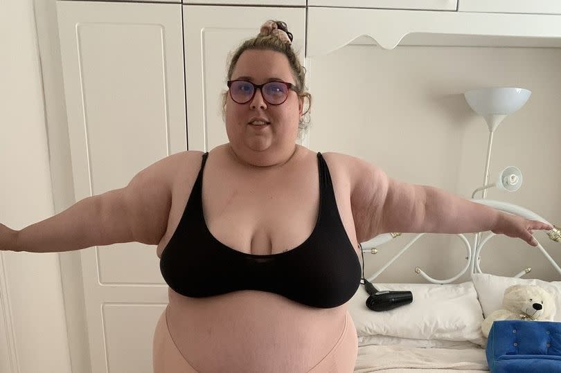 Martha McCarthy before her surgery and weight loss