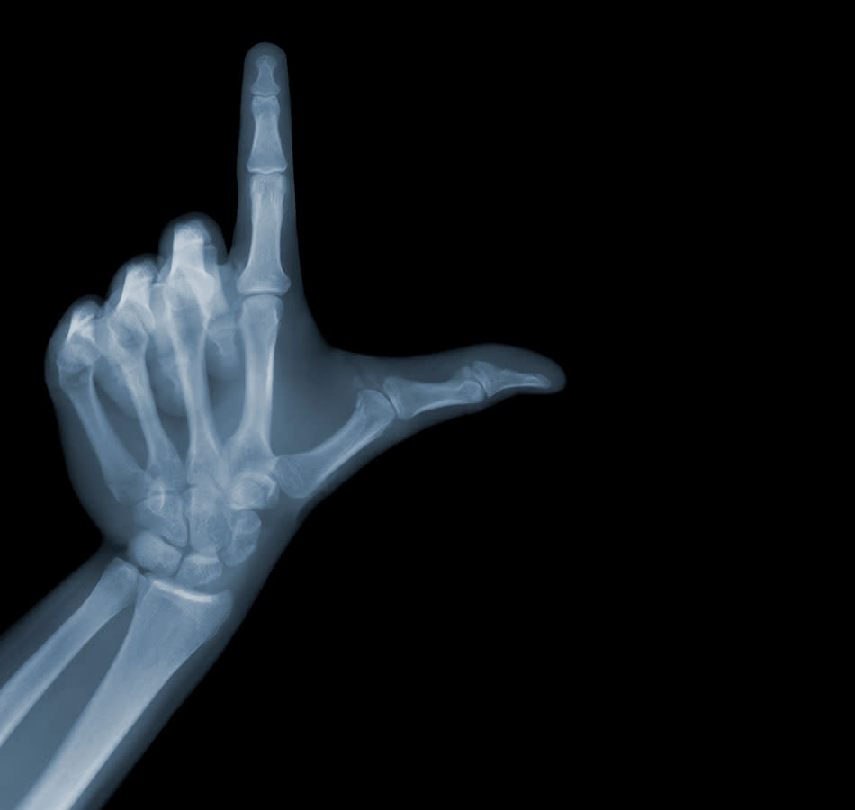 Fascinating X-ray photographs by Nick Veasey svkg 210612