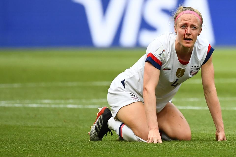 United States' defender Becky Sauerbrunn bleeds after an injury during the France 2019 Womens World Cup football final match between USA and the Netherlands, on July 7, 2019, at the Lyon Stadium in Lyon, central-eastern France. (Photo by FRANCK FIFE / AFP)        (Photo credit should read FRANCK FIFE/AFP/Getty Images)