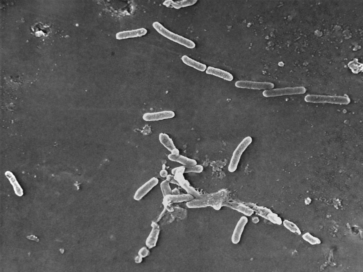 FILE - This scanning electron microscope image made available by the Centers for Disease Control and Prevention shows rod-shaped Pseudomonas aeruginosa bacteria. U.S. health officials are advising people to stop using the over-the-counter eye drops, EzriCare Artificial Tears, that have been linked to an outbreak of drug-resistant infections of Pseudomonas aeruginosa. The Centers for Disease Control and Prevention on Wednesday night, Feb. 1, 2023, sent a health alert to physicians, saying the outbreak includes at least 55 people in 12 states. One died. (Janice Haney Carr/CDC via AP)