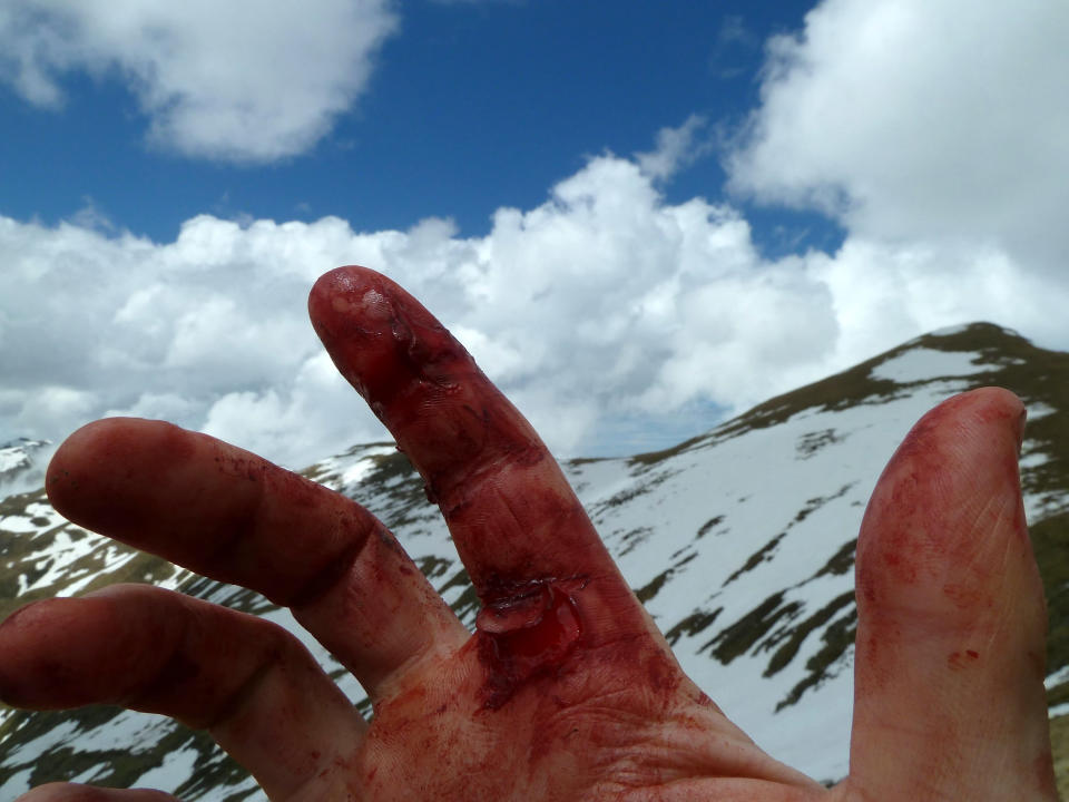 Andi Beauer holds up his bloodied hand after the attack (Picture: SWNS)