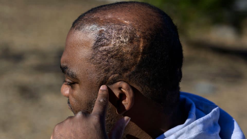 “My therapy is helping people,” Oronde McClain says. “I have to wake up and save somebody every day.” - Angela Weiss/AFP/Getty Images