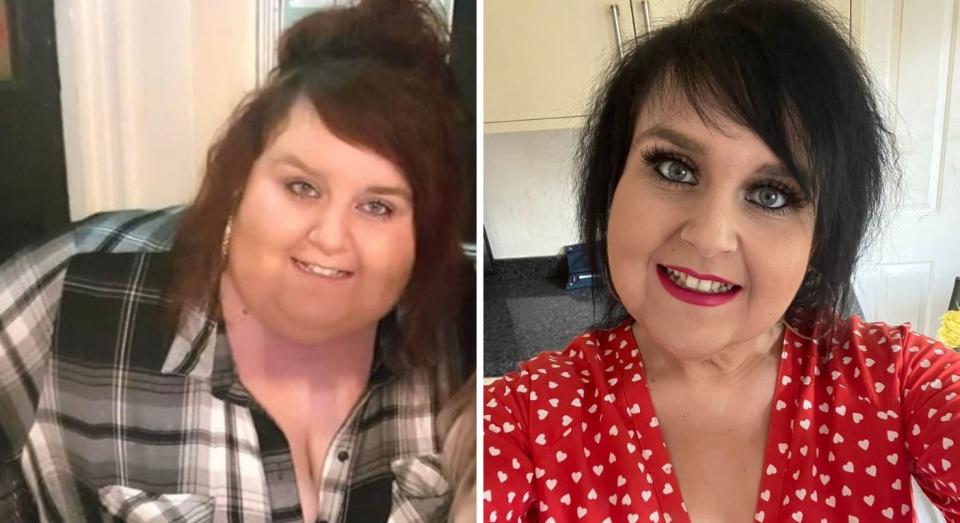 Bethany saw 19st weight loss following her surgery. (SWNS)