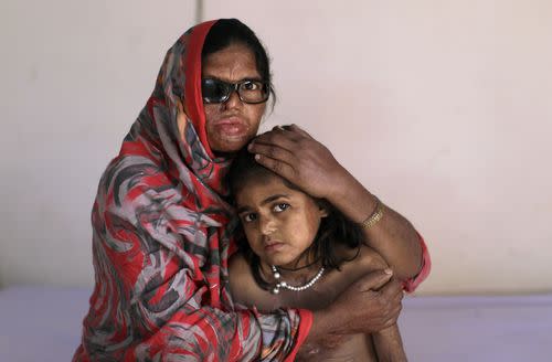 What's India Doing to Stop Acid Attacks?