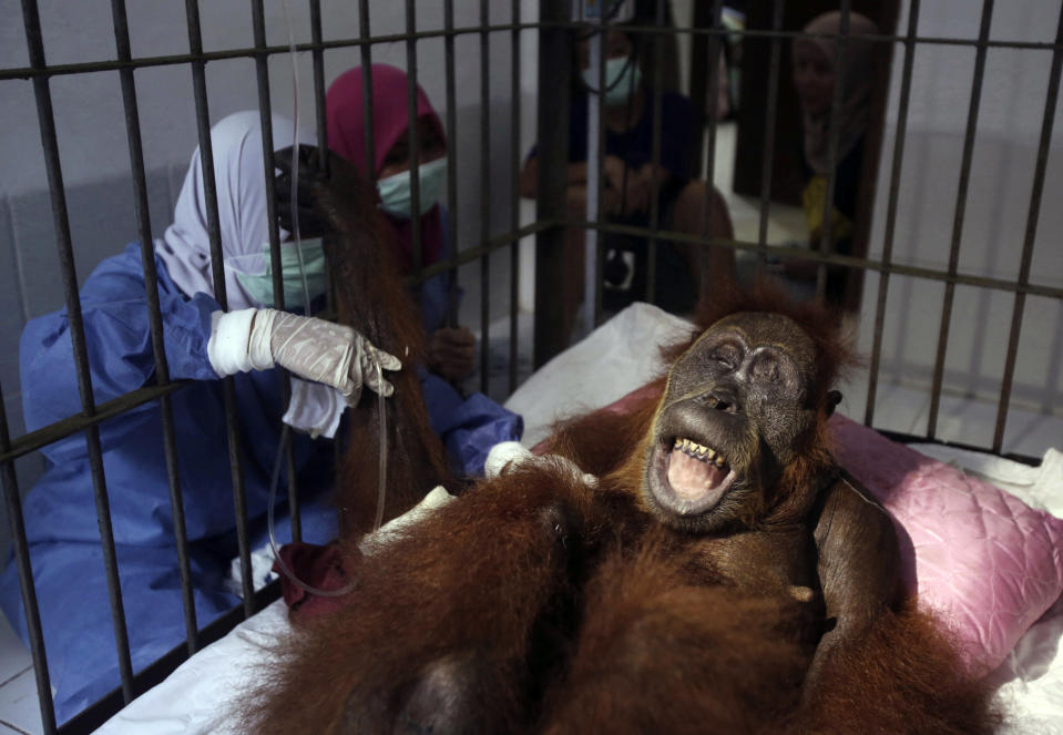 CAPTION CORRECTS TYPE OF SURGERY - In this photo taken on Sunday, March 17, 2019, veterinarians and volunteers of Sumatra Orangutan Conservation Programme (SOCP) tend to a female orangutan they named 'Hope' after conducting a surgery for infections in some parts of the body and to fix broken bones, at SOCP facility in Sibolangit, North Sumatra, Indonesia. A veterinarian says the endangered orangutan that had a young baby has gone blind after being shot at least 74 times, including six in the eyes, with air gun. The baby orangutan died from malnutrition last Friday as rescuers rushed the two to the facility. (AP Photo/Binsar Bakkara)