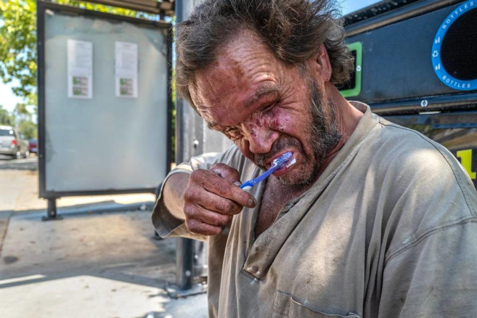 Mark Rippee brushes his teeth at a bus stop in Vacaville on July 27. Blinded after a motorcycle accident at the age of 24, he is homeless and often is beaten up and has his belongings stolen while trying to survive on the streets.