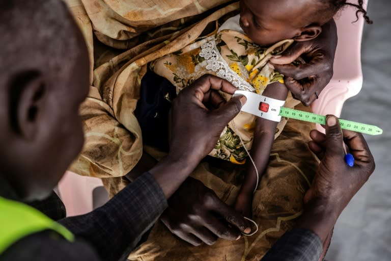 A health worker measures a Sudanese child's arm at a clinic in Renk, in neighbouring South Sudan (LUIS TATO)