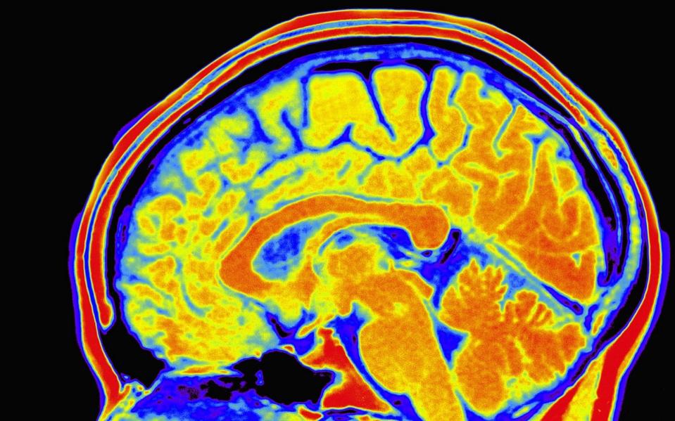 Intelligence could be measured with a swab of saliva