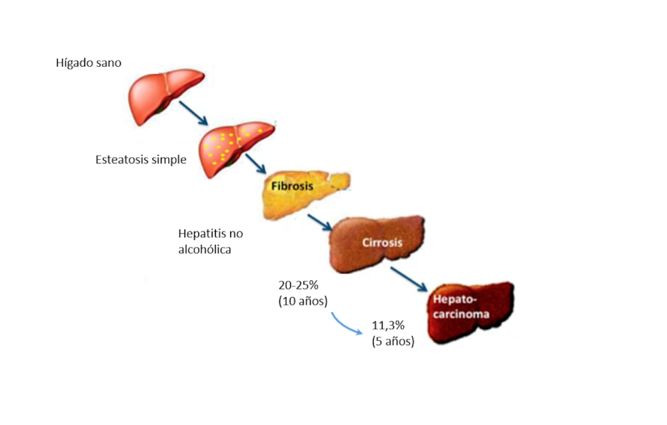 Estados de un hígado dañado.