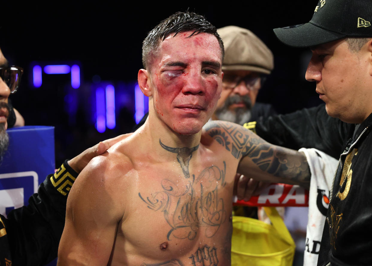 GLENDALE, ARIZONA - AUGUST 12: Oscar Valdez has his eyes damaged during his WBO junior lightweight championship fight against Emanuel Navarrete, at Desert Diamond Arena on August 12, 2023 in Glendale, Arizona. (Photo by Mikey Williams/Top Rank Inc via Getty Images)