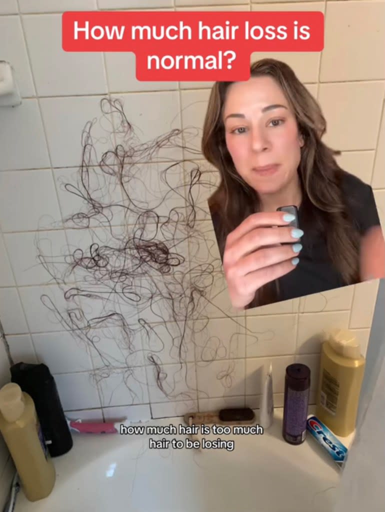 Board-certified dermatologist Lindsey Zubritsky is revealing when you should be concerned about hair loss — basically, if you’re shedding 400 or more hairs a day. TikTok