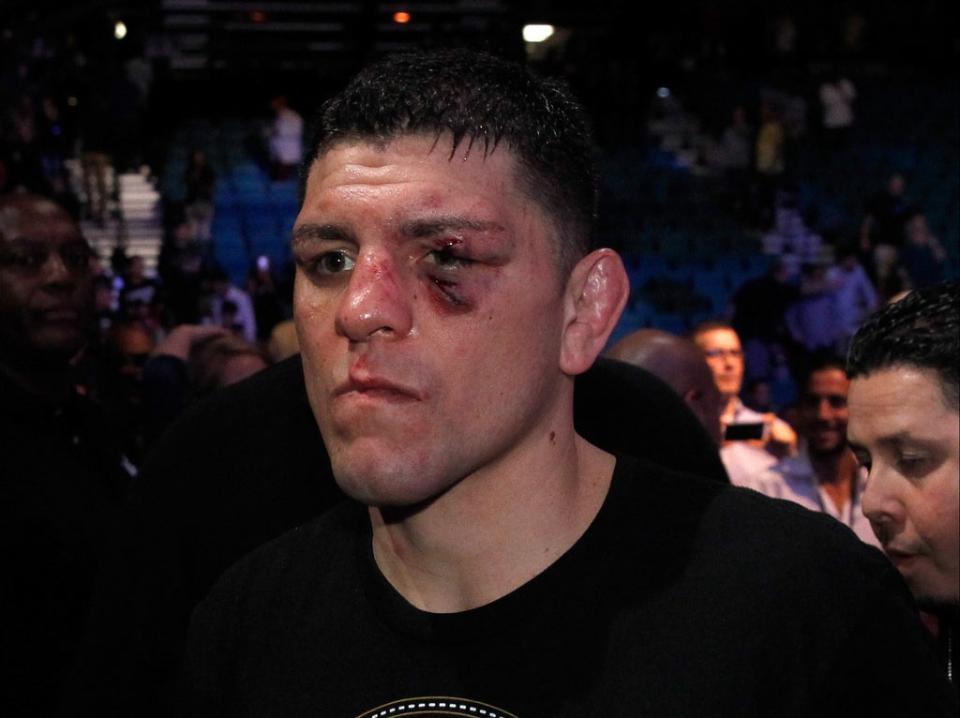 Nick Diaz after his last fight, in 2015 (Getty Images)