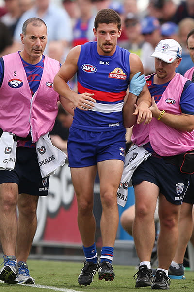 Liberatore will miss the entire 2015 AFL season after tearing the ACL in his left knee, during a pre-season hit-out against Richmond.