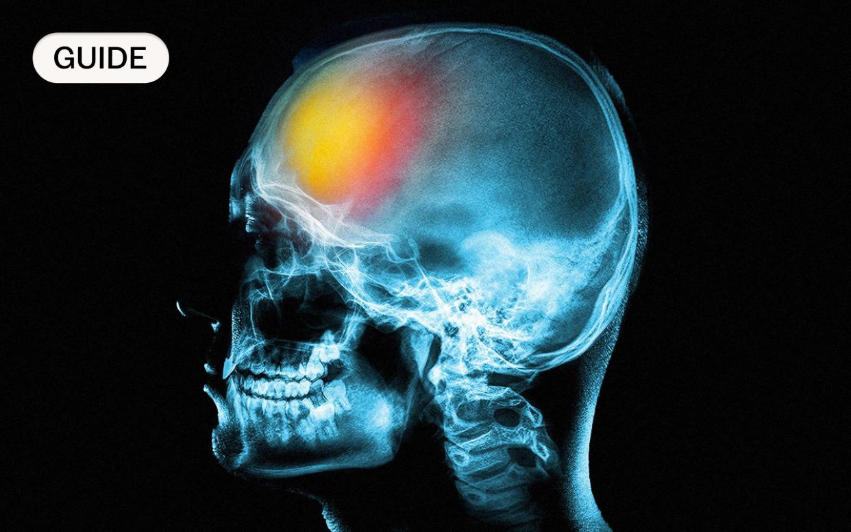 Frontotemporal dementia