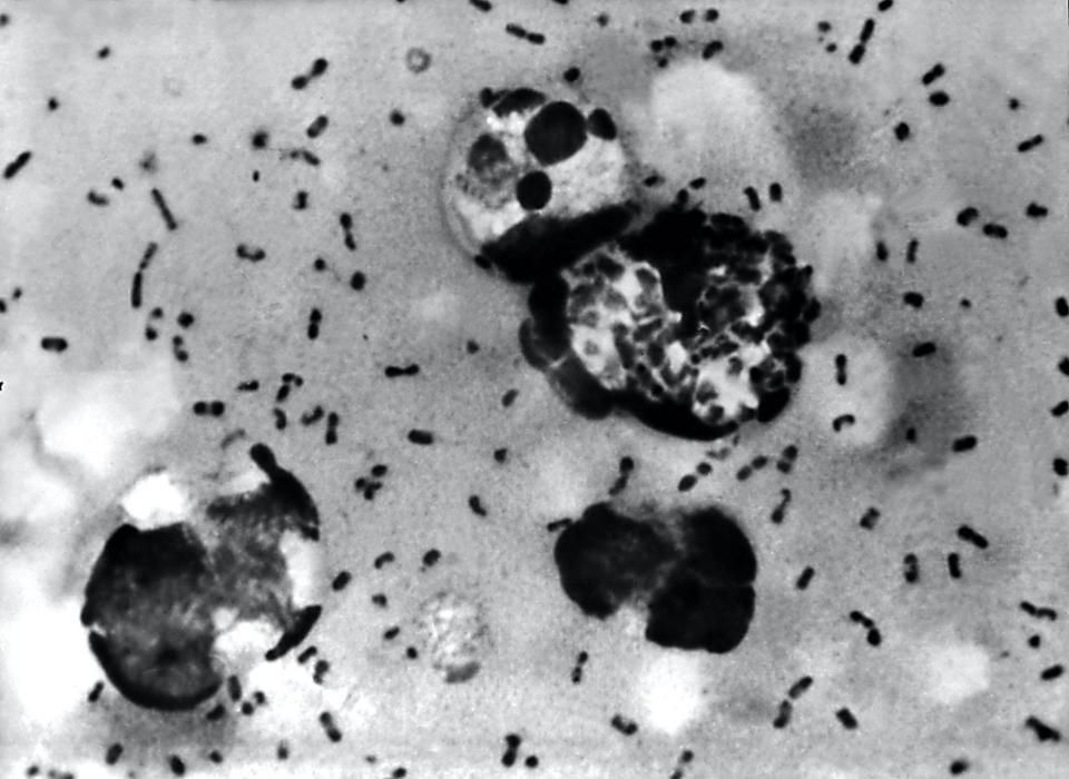 bubonic plague bacteria