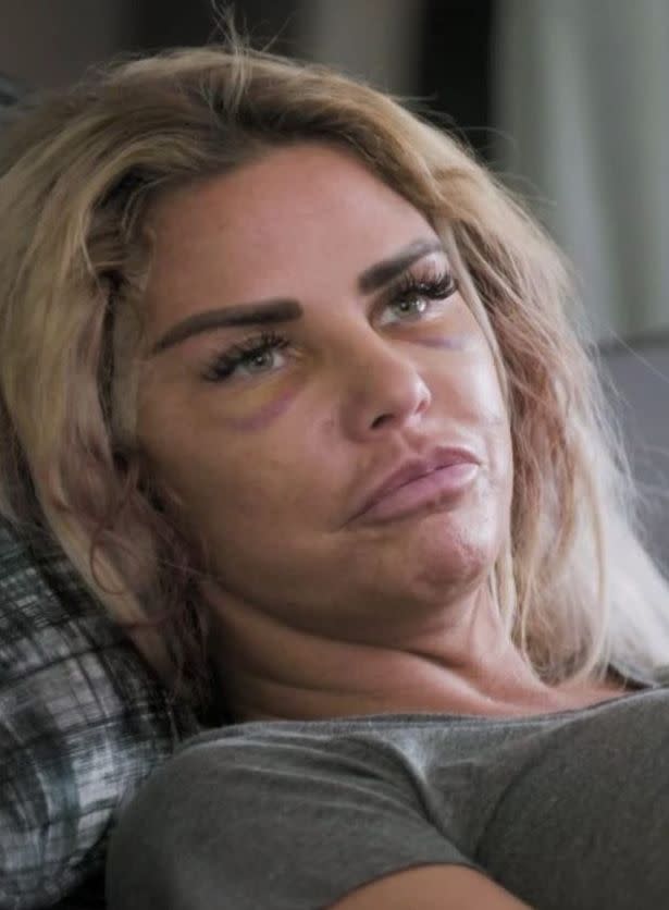 Katie Price is reportedly suffering from 'gruesome wounds' following a recent facelift (Photo: Red Quest)