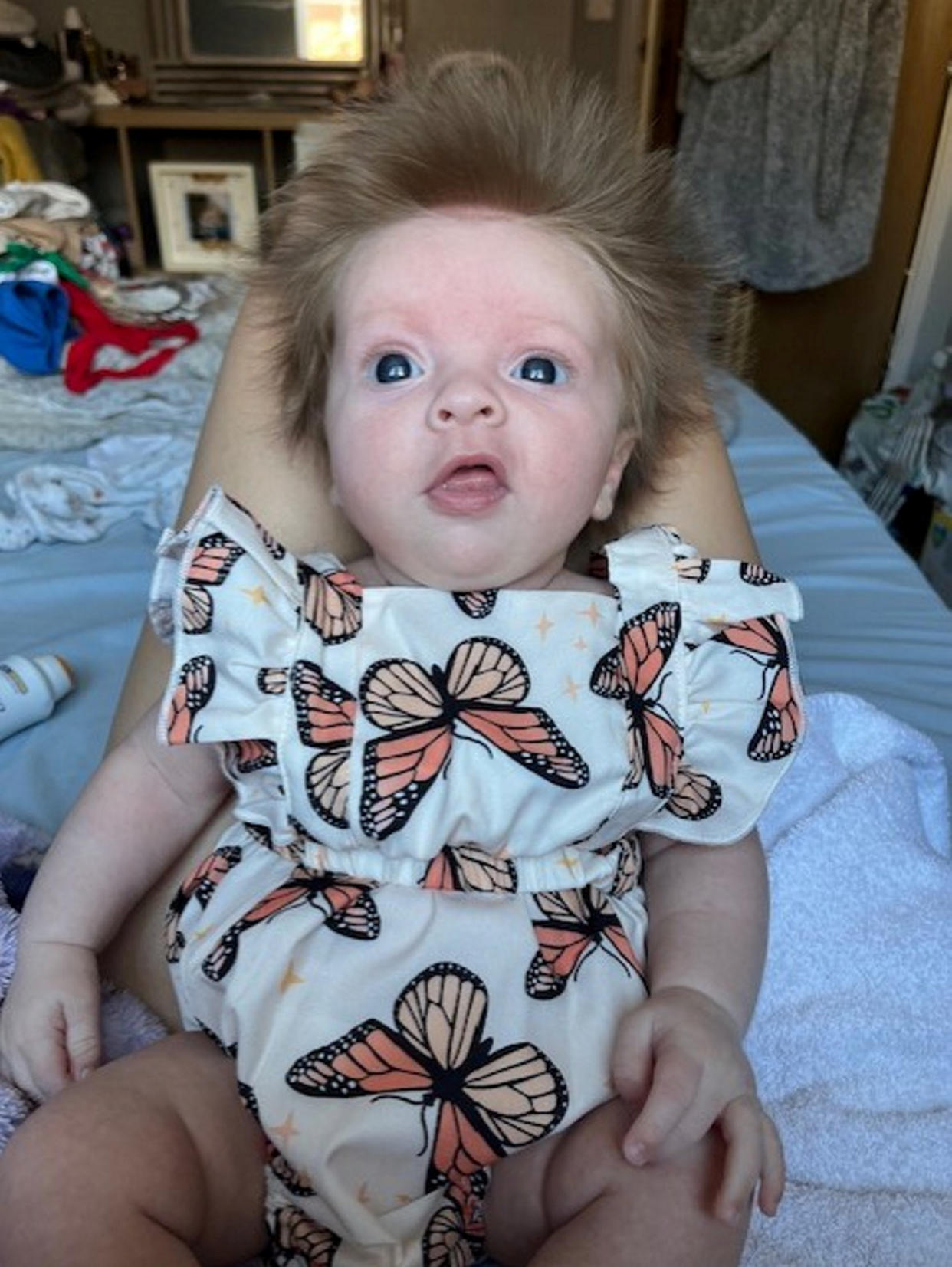 Lewis says Arla's locks started growing out after her first bath and have continued to grow since. (Aliyah Lewis/SWNS)