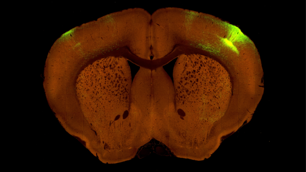 This image shows a single section from a mouse brain. Neurons in one layer of the sensory cortex (the very dense yellow color on the right) were labeled with green fluorescence to trace all the pathways arising from these cells across the brain. When these axons reach their cortical targets, they form synaptic connections across the layers of the cortex with distinct patterns associated with the direction of information routing. (Allen Institute Image)