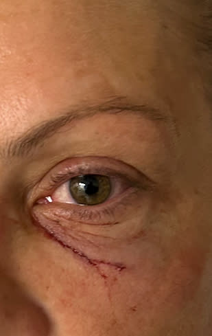 A female correction officer was punched in the face Sunday, leaving her with several facial fractures.