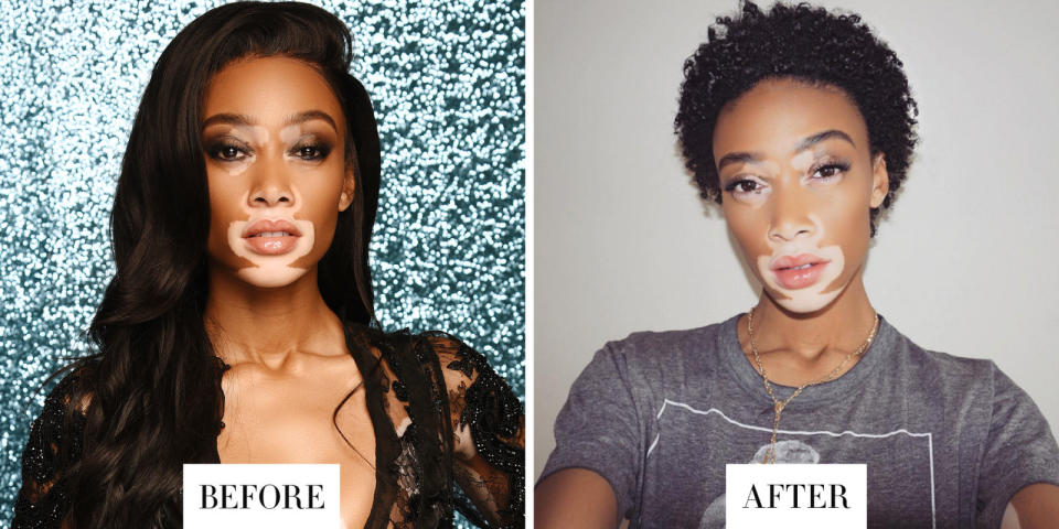 Winnie Harlow