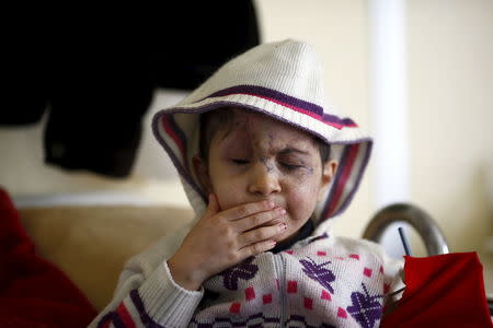 Five-year old Sheima, who lost both eyes when hit by a stray bullet in Syria, sits on her hospital bed in a small clinic near the Turkish-Syrian border in the southeastern city of Kilis, Turkey February 9, 2016. REUTERS/Osman Orsal