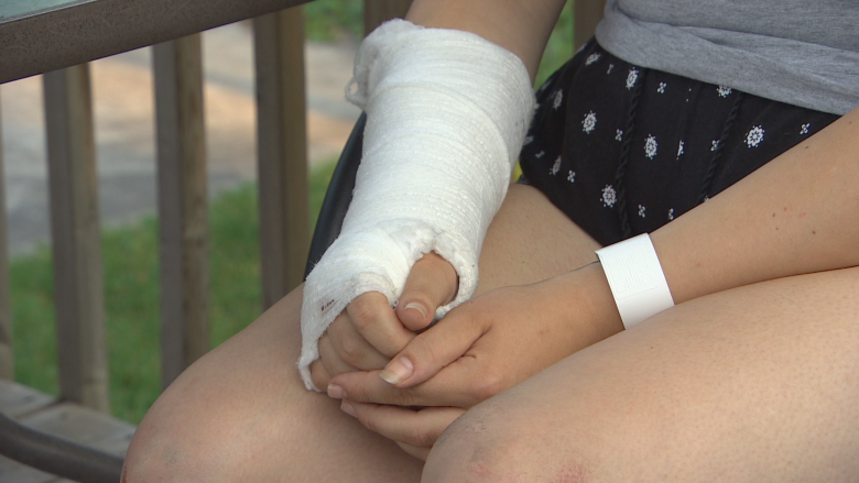 'My head hit the concrete': Woman survives 'surreal' hit and run in East Kildonan