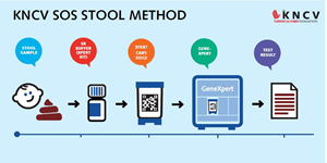 A stool sample is painless and easy to obtain from children. KNCV laboratory experts dove into the matter and developed the SOS Stool Method.