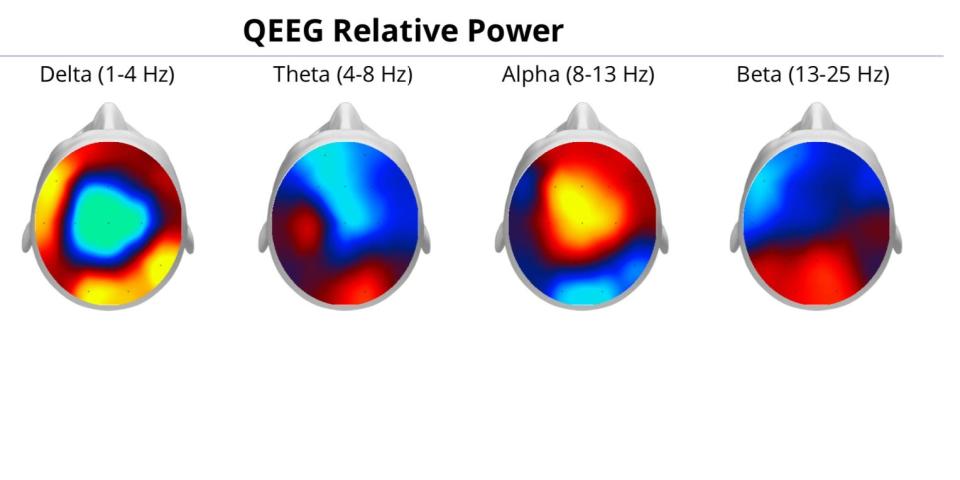 Brain wave relative power scan